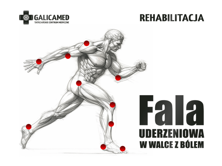 Fala uderzeniowa Podhale - Poradnia rehabilitacyjna GalicaMed